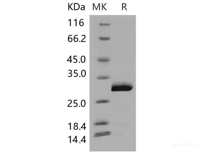 Recombinant Mouse UCHL3 / UCH-L3 Protein (His tag)-Elabscience