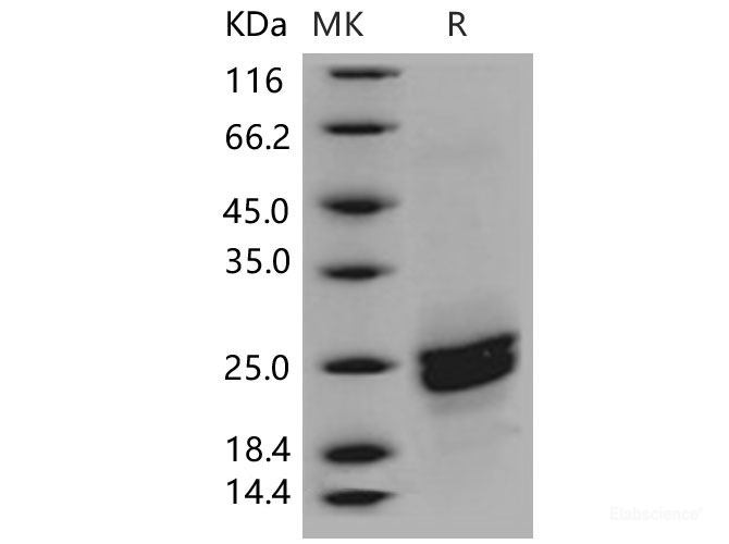 Recombinant Mouse PLA2G12B / PLA2G13 Protein (His tag)-Elabscience