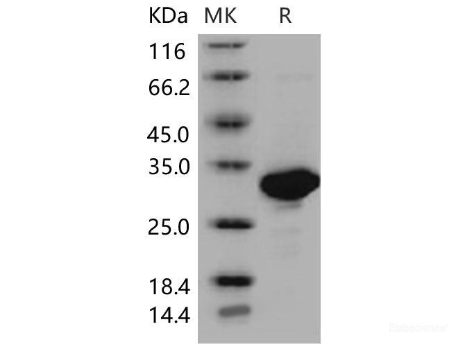 Recombinant Mouse Carbonic Anhydrase II / Car2 Protein (His tag)-Elabscience