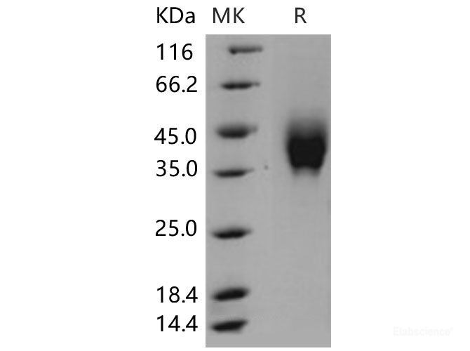 Recombinant Mouse IFNGR2 Protein (His tag)-Elabscience