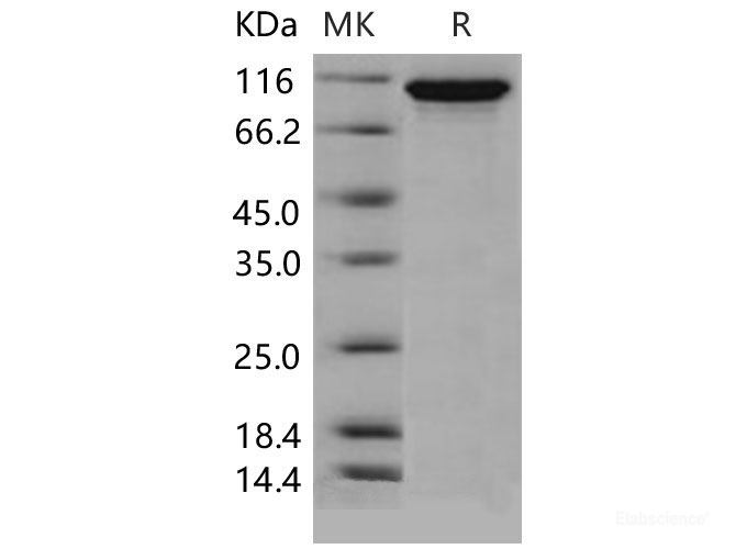 Recombinant Mouse Autotaxin / ENPP2 / NPP2 Protein (His tag)-Elabscience