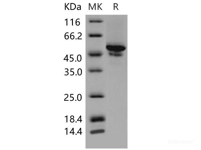 Recombinant Mouse Carbonic Anhydrase IX / Car9 Protein (His tag)-Elabscience