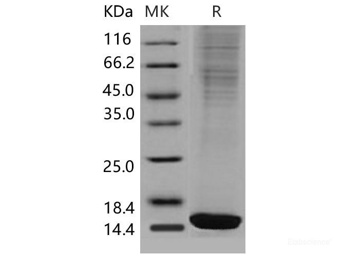 Recombinant Mouse FABP4 / ALBP / A-FABP Protein (His tag)-Elabscience