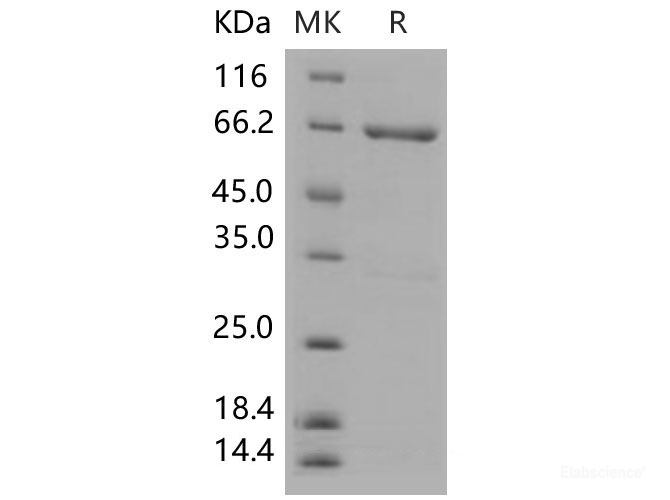 Recombinant Mouse MKK4 / MEK4 / MAP2K4 Protein (His & GST tag)-Elabscience