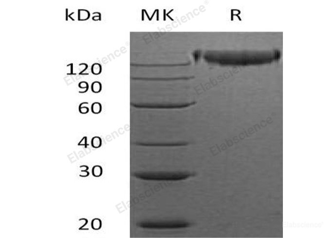 Recombinant Mouse  Semaphorin 4D Protein (His Tag)-Elabscience