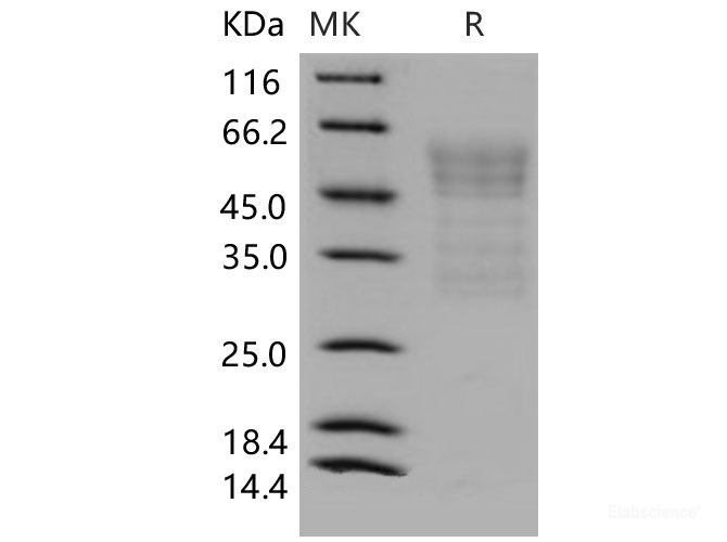 Recombinant Mouse Syndecan-1 / SDC1 / CD138 Protein (His tag)-Elabscience