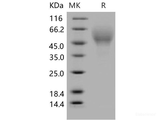 Recombinant Mouse CD200R4 / CD200 Receptor 4 / CD200RLa Protein (His tag)-Elabscience