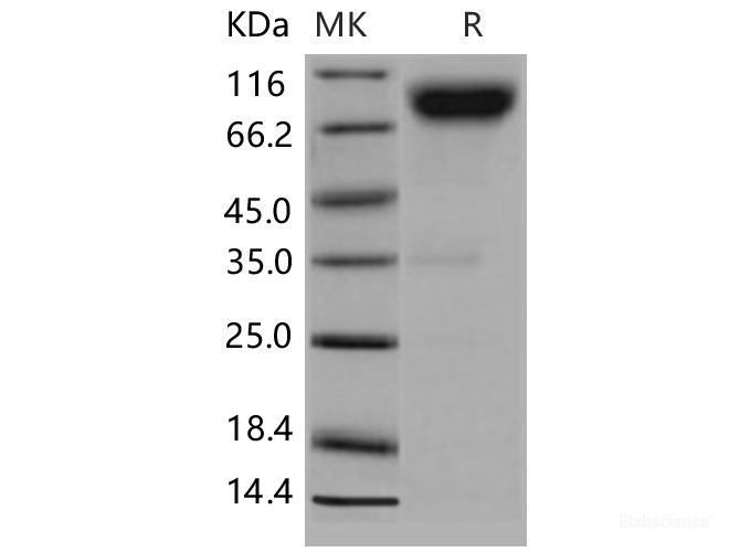 Recombinant Mouse CD200R4 / CD200 Receptor 4 / CD200RLa Protein (Fc tag)-Elabscience