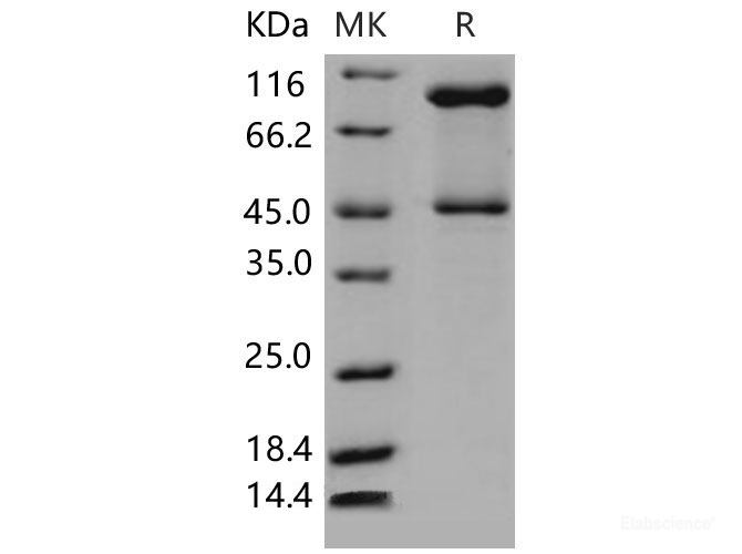 Recombinant Mouse Serpinb3c Protein (His tag)-Elabscience