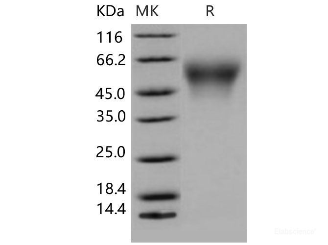 Recombinant Mouse CES5 / Carboxylesterase-5 Protein (His tag)-Elabscience