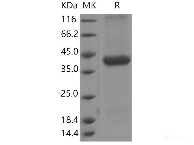 Recombinant Mouse  Cathepsin H Protein (His Tag)-Elabscience
