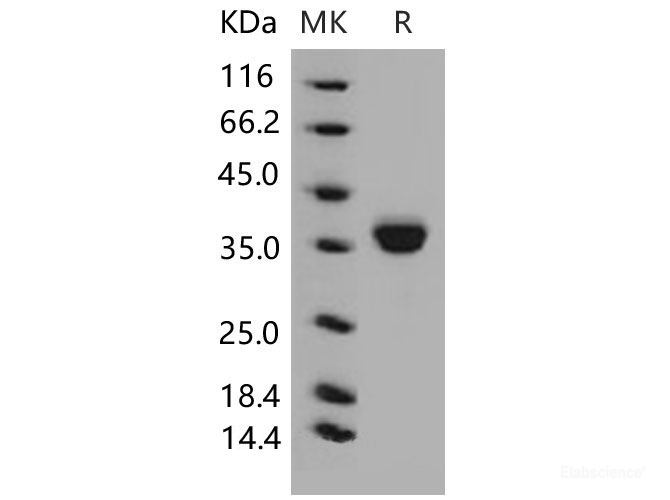Recombinant Mouse EpCAM / TROP-1 / TACSTD1 Protein (His tag)-Elabscience