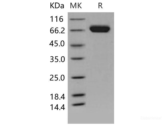 Recombinant Mouse EphA7 / EHK-3 Protein (His tag)-Elabscience