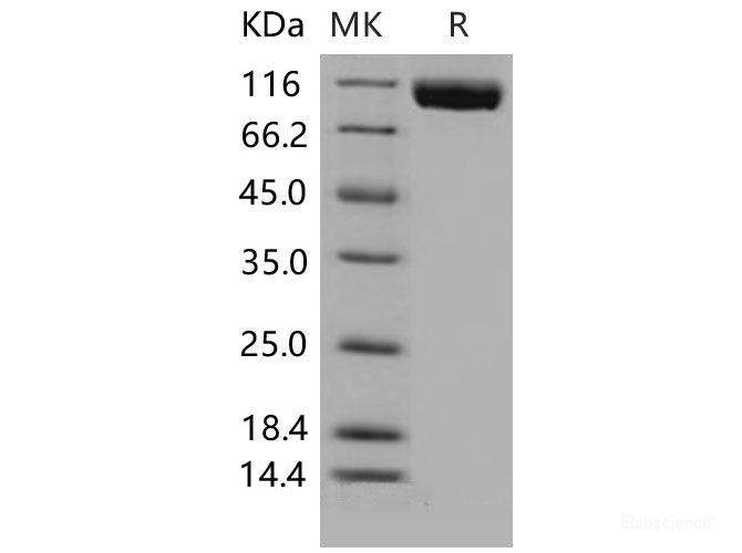 Recombinant Mouse VEGFR3 / FLT-4  Protein (His tag)-Elabscience