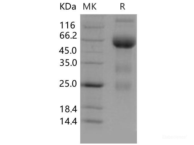Recombinant Mouse VEGFR3 / FLT-4  Protein (Fc tag)(Fc tag)-Elabscience