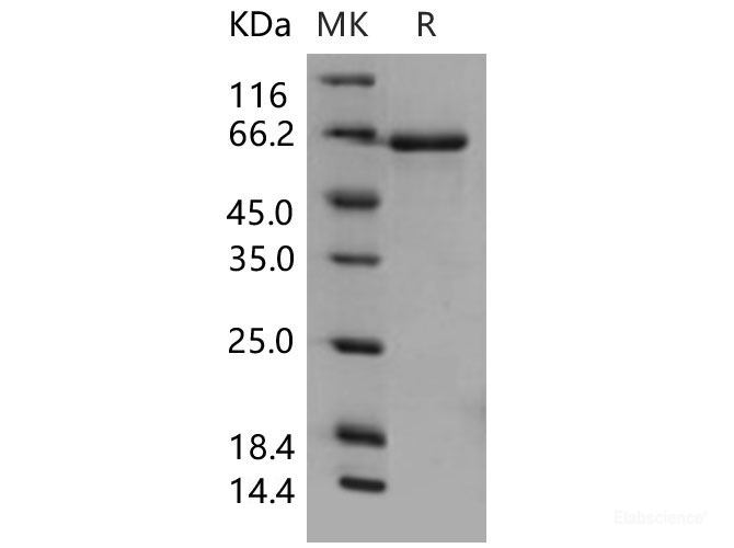 Recombinant Mouse EphB3 / HEK2 Protein (His tag)-Elabscience