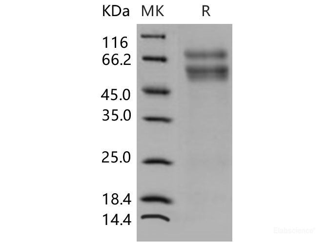 Recombinant Mouse CHST3 / C6ST-1 Protein (His tag)-Elabscience