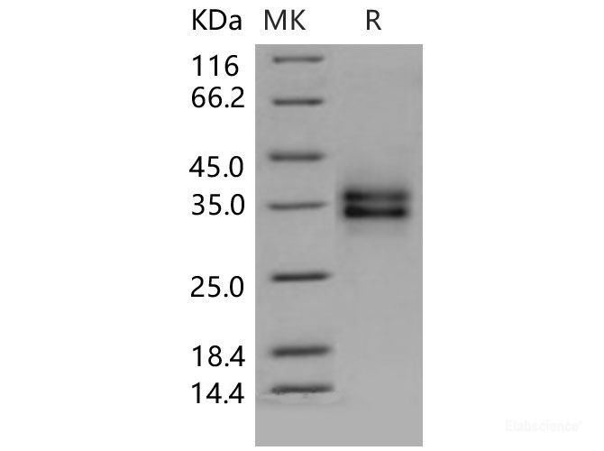 Recombinant Mouse FOLR1 / FR-alpha Protein (His tag)-Elabscience