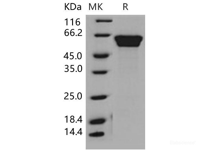 Recombinant Mouse Fetuin-B / FETUB Protein (His tag)-Elabscience