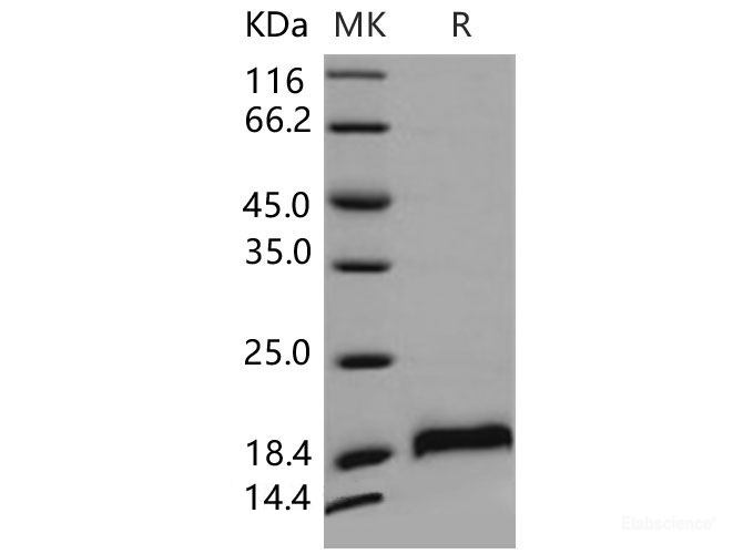 Recombinant Mouse CDNF / ARMETL1 Protein (His tag)-Elabscience