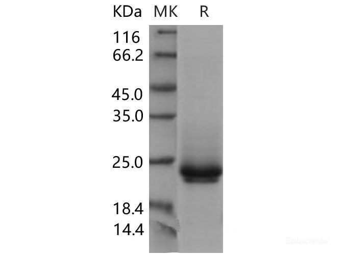 Recombinant Mouse Frizzled-10 / FZD10 Protein (His tag)-Elabscience