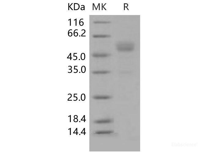 Recombinant Mouse Frizzled-10 / FZD10 Protein (Fc tag)(Fc tag)-Elabscience