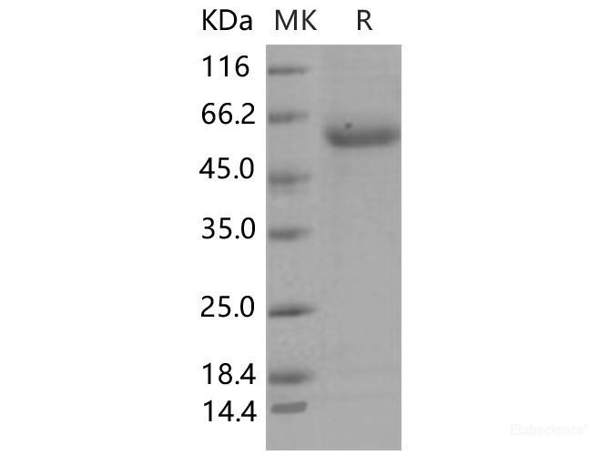 Recombinant Mouse ENPP7 / NPP-7 Protein (His tag)-Elabscience