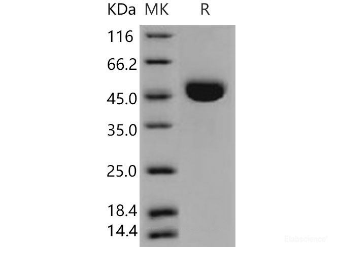 Recombinant Mouse  Cathepsin E Protein (His Tag)-Elabscience