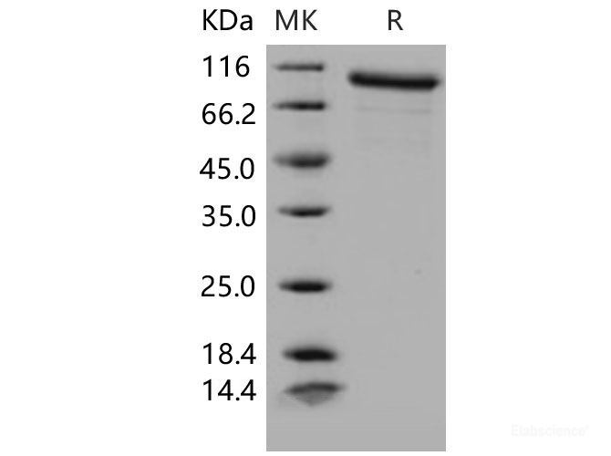 Recombinant Mouse MMP-9 Protein-Elabscience