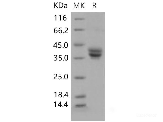 Recombinant Mouse GPA33 / Glycoprotein A33 Protein (His tag)-Elabscience