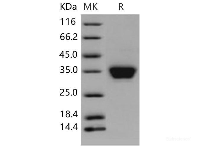 Recombinant Mouse ASAM / CLMP Protein (His tag)-Elabscience