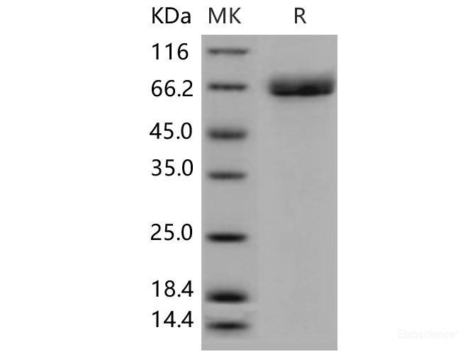 Recombinant Mouse Acetylcholinesterase / ACHE Protein (His tag)-Elabscience