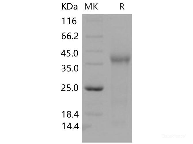 Recombinant Mouse TGFBR3 / Betaglycan Protein (His tag)-Elabscience