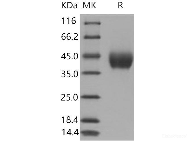 Recombinant Mouse  Factor D Protein (His Tag)-Elabscience
