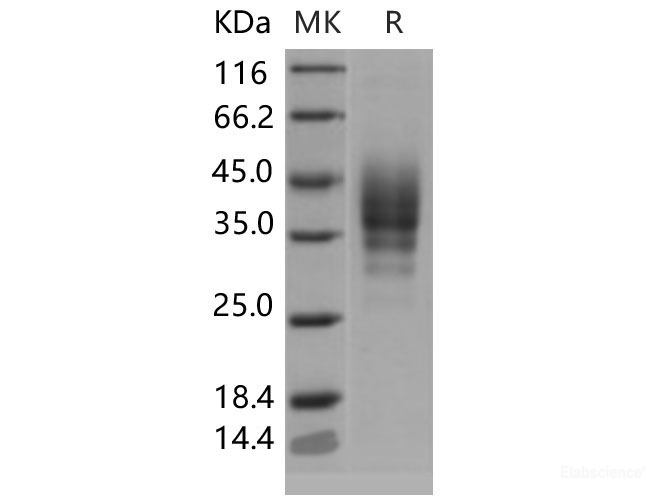 Recombinant Mouse CD2 / LY37 Protein (His tag)-Elabscience