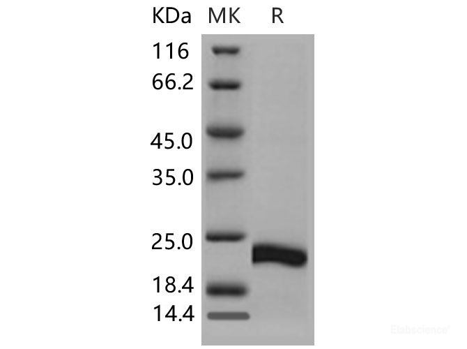 Recombinant Mouse CSRP1 / CSRP / CRP1 Protein (His tag)-Elabscience