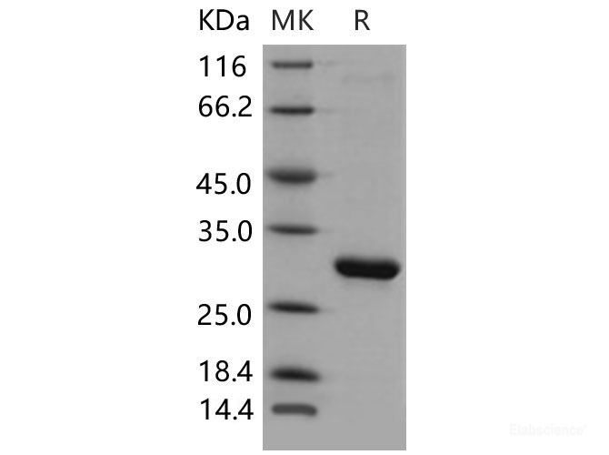 Recombinant Mouse HPGD / 15-PGDH Protein (His tag)-Elabscience