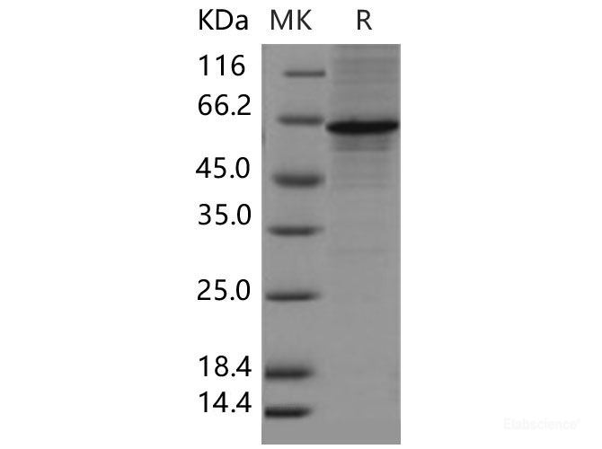 Recombinant Mouse METAP2 / MAP2 Protein (His tag)-Elabscience