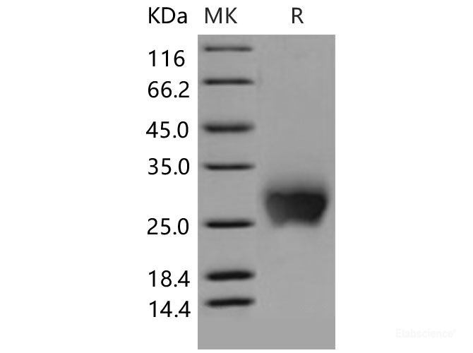 Recombinant Mouse CTLA4 / CD152 Protein (His tag)-Elabscience