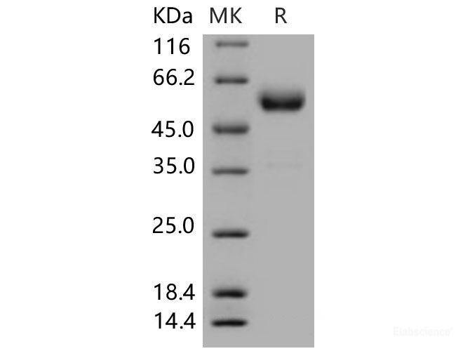 Recombinant Mouse CTLA4 / CD152 Protein (Fc tag)-Elabscience