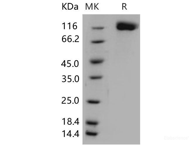 Recombinant Mouse OSMR / IL-31RB Protein (His tag)-Elabscience