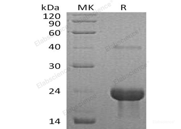 Recombinant Mouse  TNFRSF1A Protein (His Tag)-Elabscience