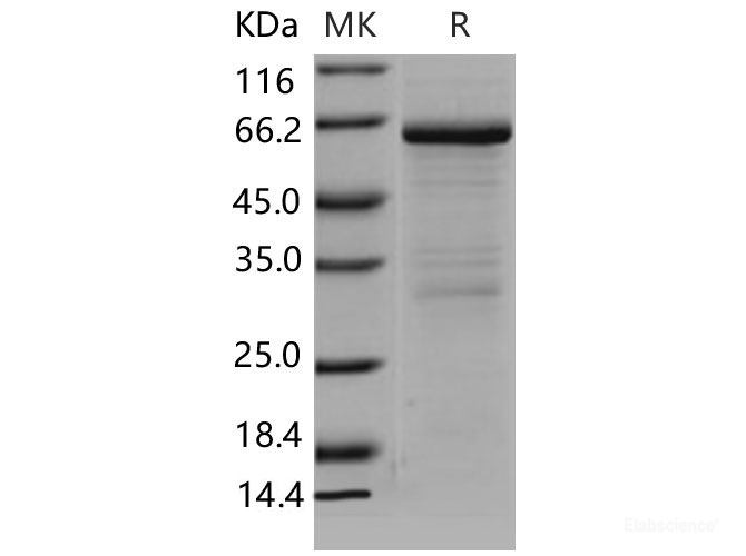 Recombinant Mouse MMP-8 / CLG1 Protein-Elabscience