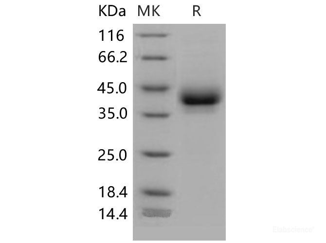 Recombinant Mouse CD209B / DC-SIGNR1 Protein (His tag)-Elabscience