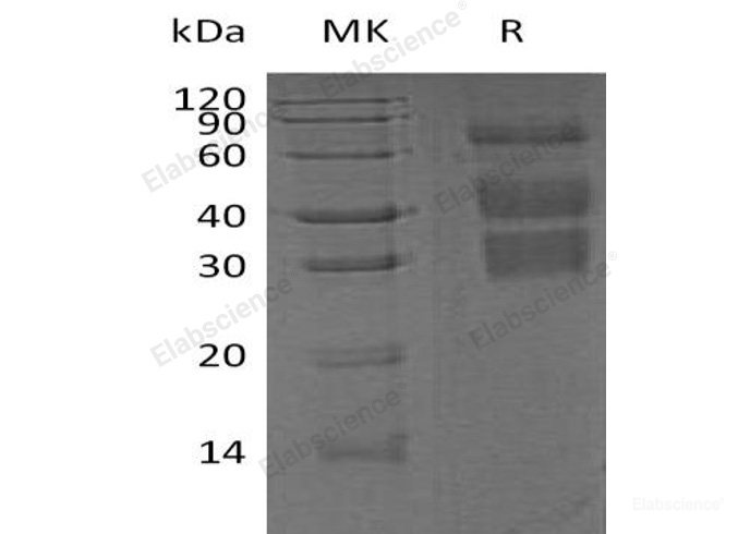 Recombinant Mouse  Clusterin Protein (His Tag)-Elabscience