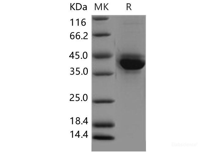 Recombinant Mouse S100A4 Protein (Fc tag)-Elabscience