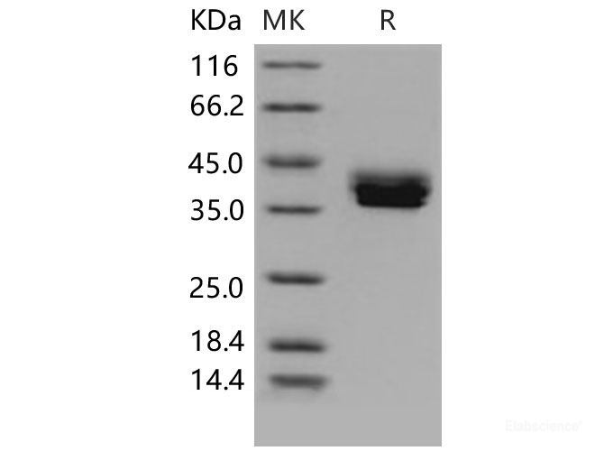 Recombinant Mouse CADM3 / NECL1 / IGSF4B Protein (His tag)-Elabscience