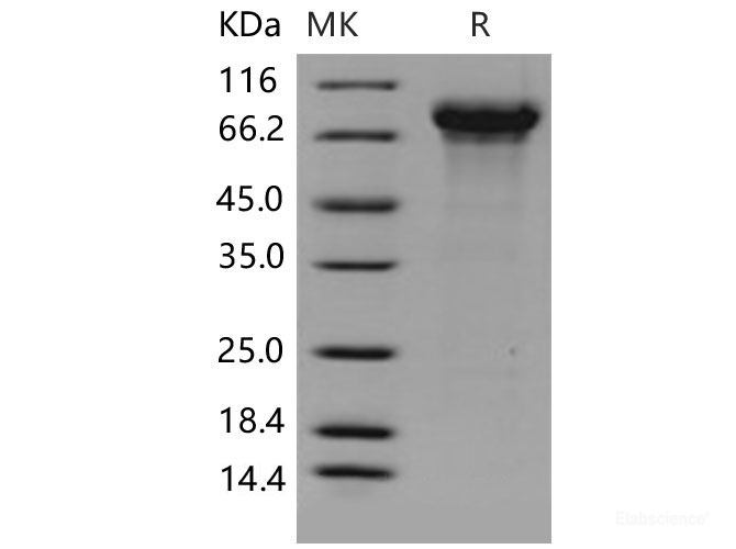 Recombinant Mouse KNG1 / BDK / kininogen-1 Protein (His tag)-Elabscience