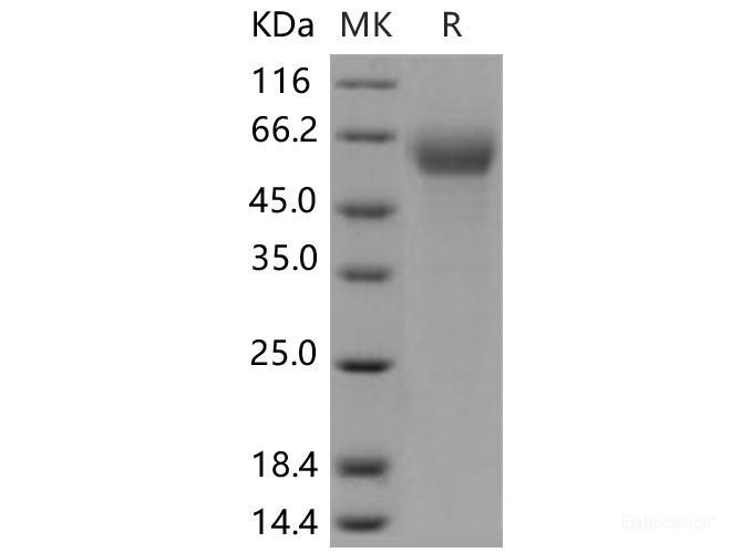 Recombinant Mouse IFNAR1 / IFNAR Protein (His tag)-Elabscience