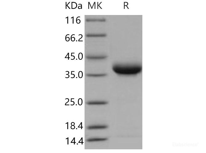 Recombinant Mouse JAM2 / CD322 / VE-JAM Protein (His tag)-Elabscience